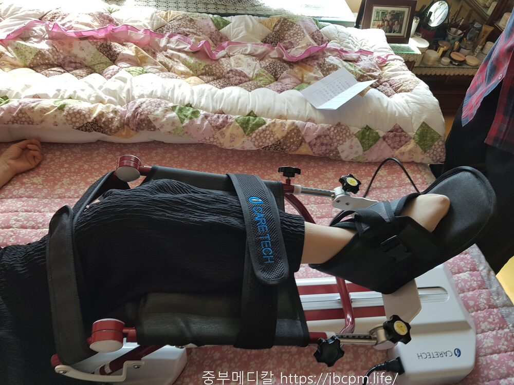 각도·속도는 의료진 지시에 맞춰 설정한 CPM 사용 모습